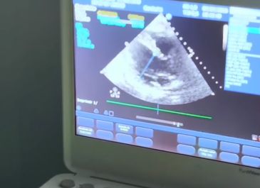 Mutirão de ecocardiogramas na Policlínica Municipal